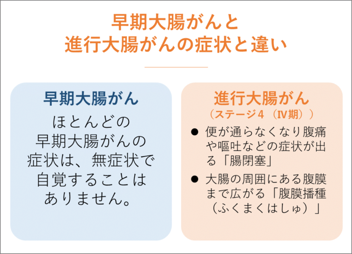 早期大腸がんと進行大腸がんの症状と違い